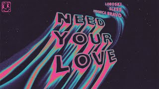Need Your Love